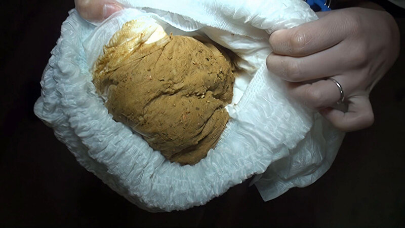 RAI-039 sample