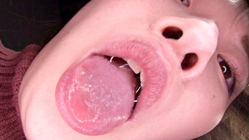 EVIS-640 sample