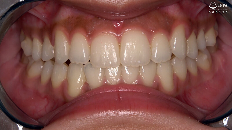 ad-2026 sample