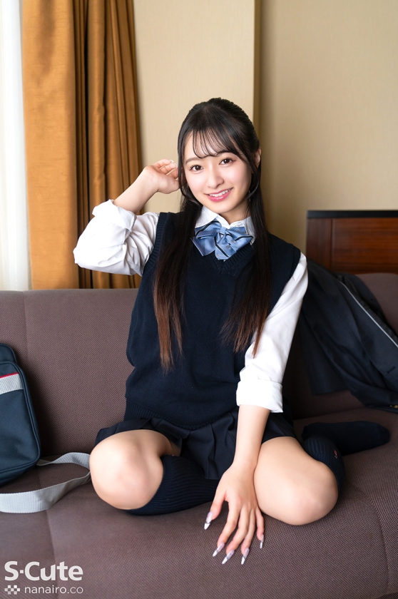 SCUTE-1576 sample