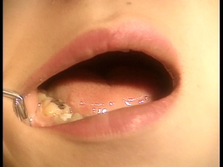 axv-014 sample