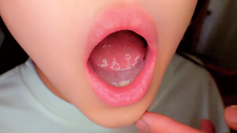 bony-107 sample