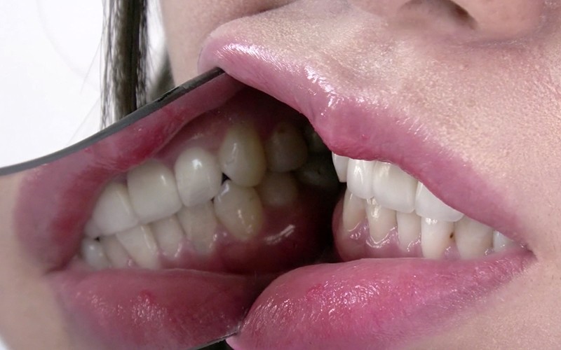 ad-340 sample