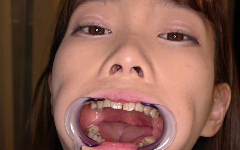 ad-534 sample