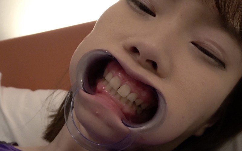ad-534 sample
