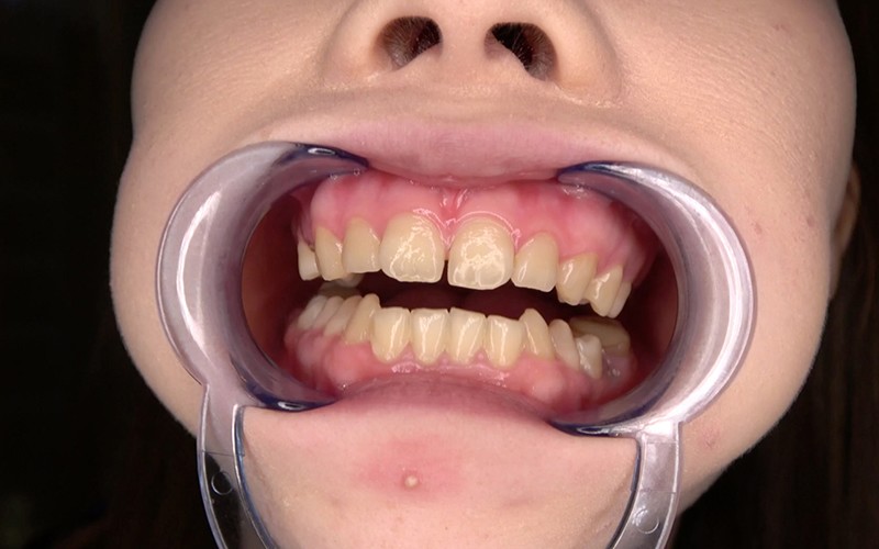 ad-534 sample