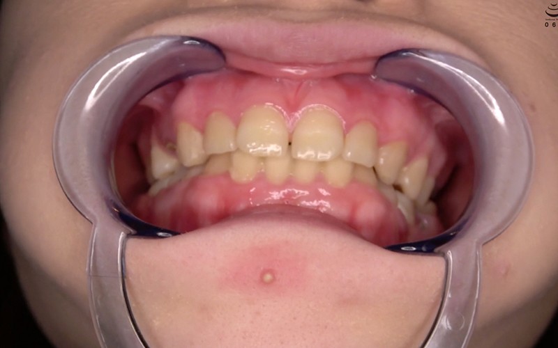 ad-534 sample