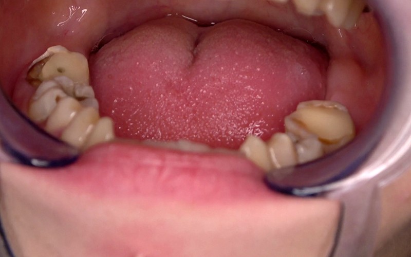 ad-534 sample