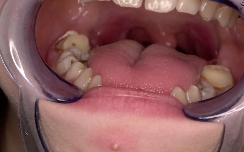 ad-534 sample