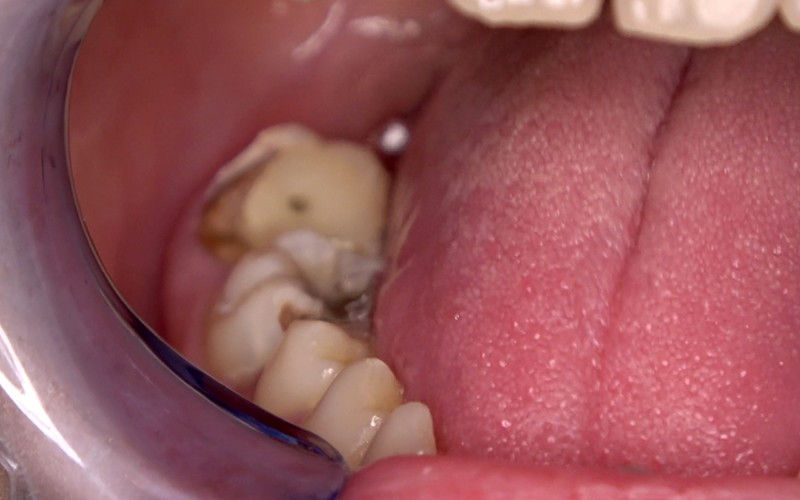 ad-534 sample