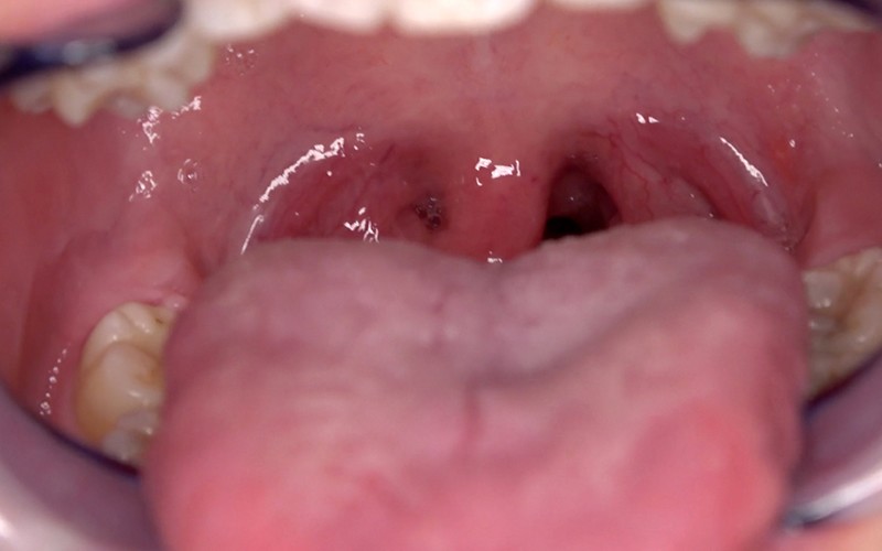 ad-565 sample