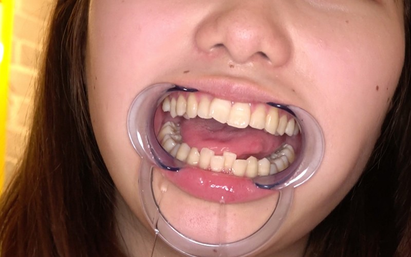 ad-565 sample