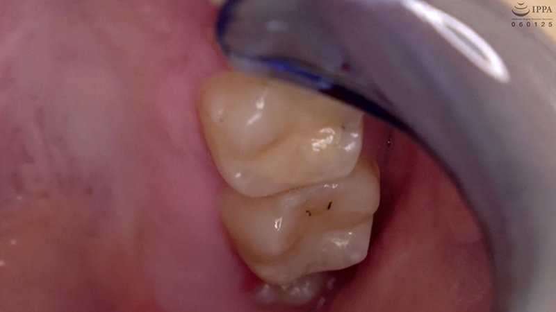 ad-692 sample