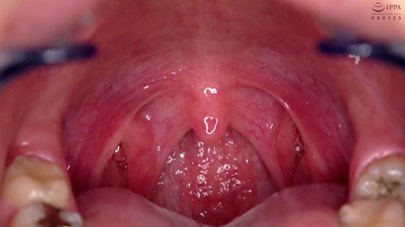 ad-692 sample
