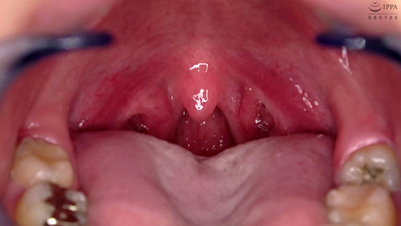 ad-692 sample