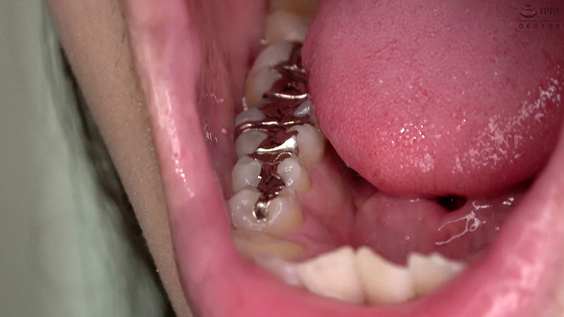 ad-692 sample