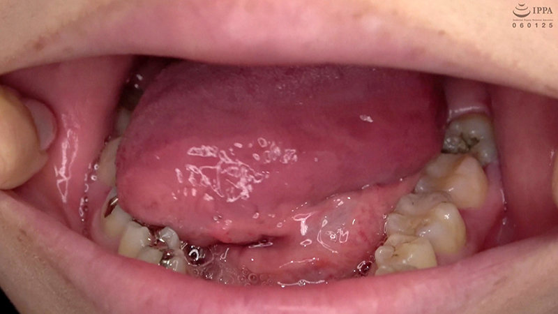 ad-692 sample