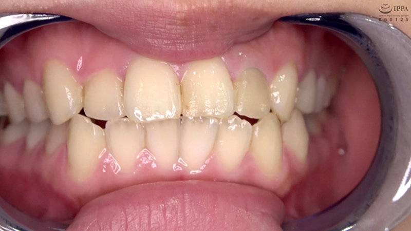 ad-692 sample