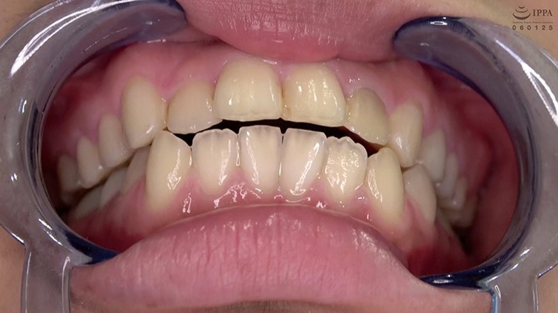 ad-692 sample