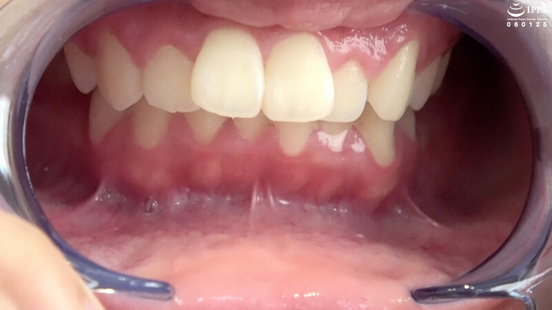 ad-854 sample