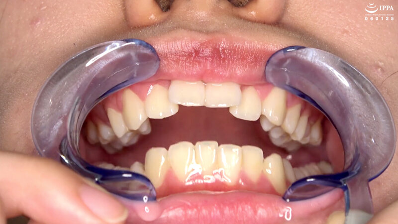 ad-854 sample