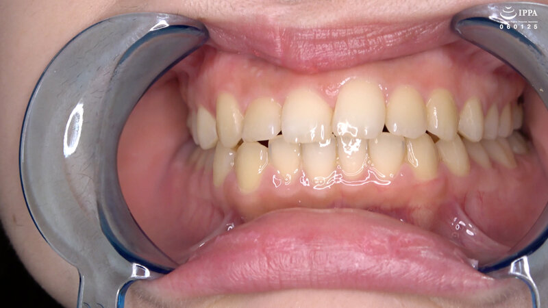 ad-1070 sample