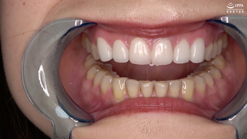 ad-1294 sample