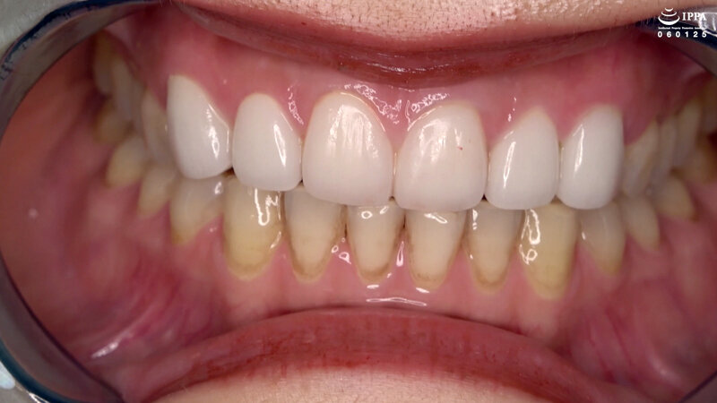 ad-1294 sample
