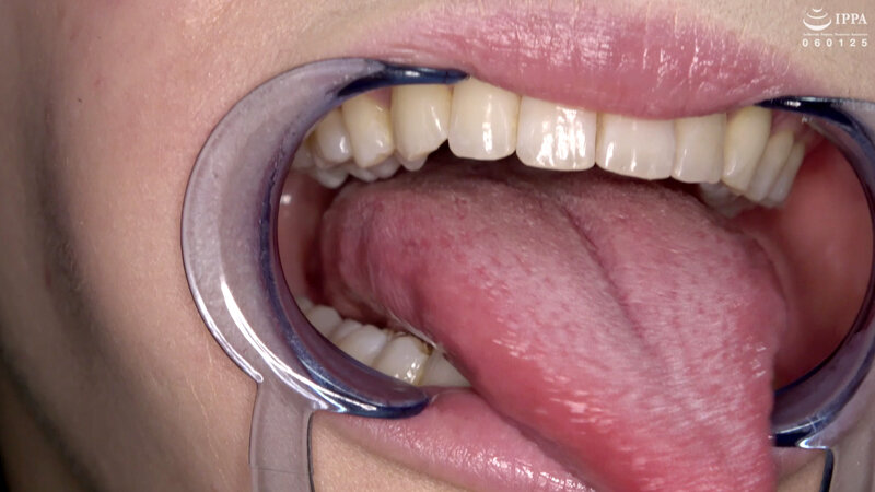 ad-1411 sample