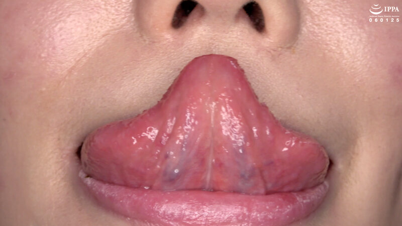 ad-1411 sample