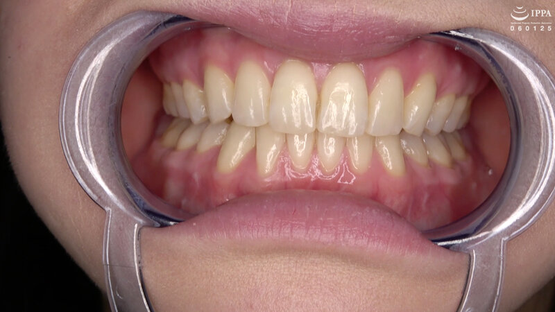 ad-1411 sample