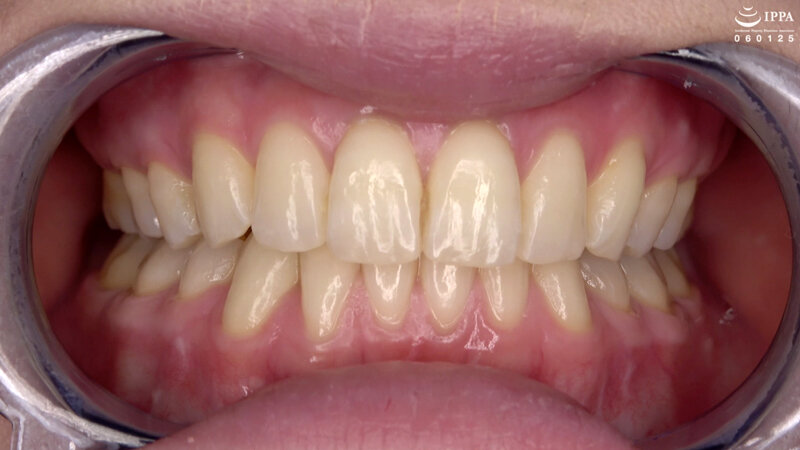 ad-1411 sample
