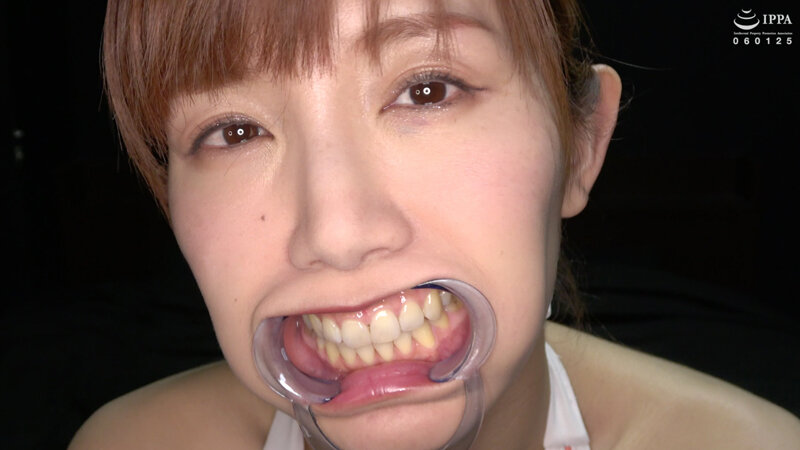 ad-1421 sample