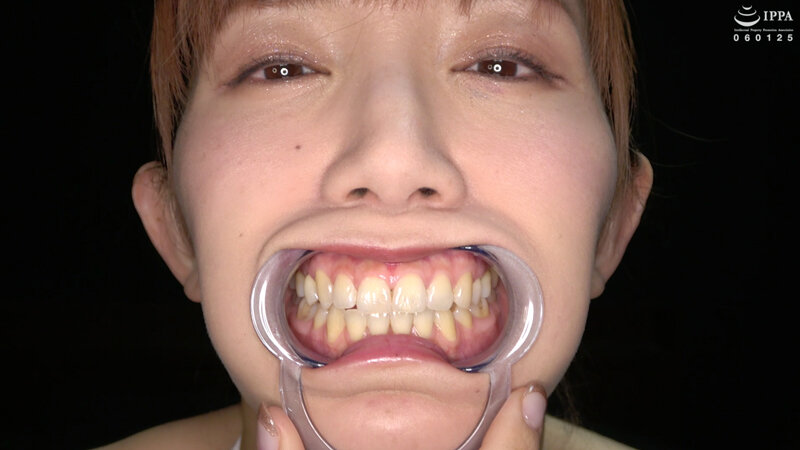 ad-1421 sample