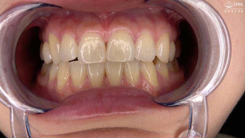 ad-1421 sample