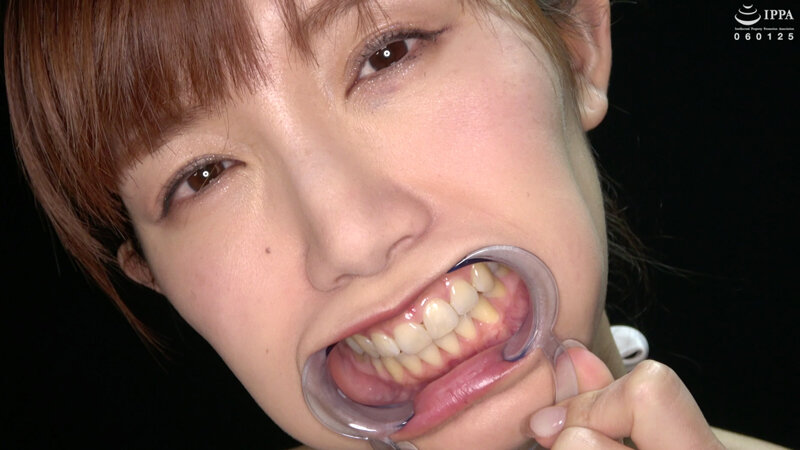 ad-1421 sample