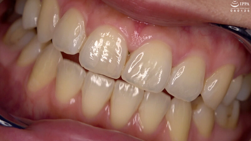 ad-1421 sample