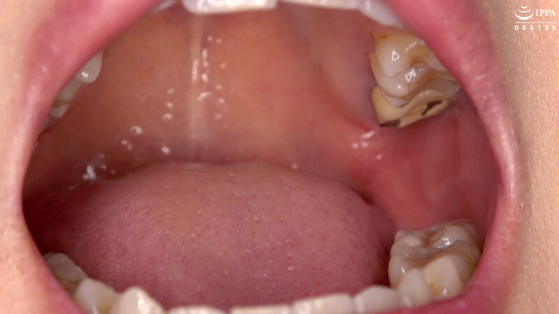 ad-1421 sample