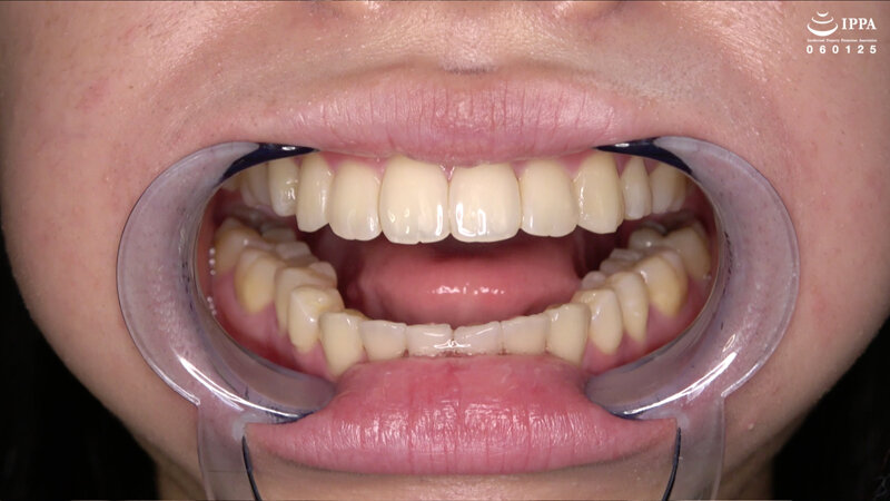ad-1525 sample