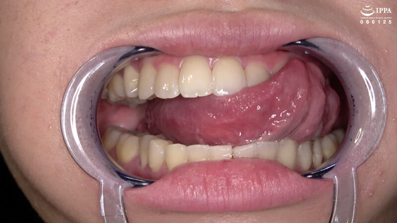 ad-1525 sample