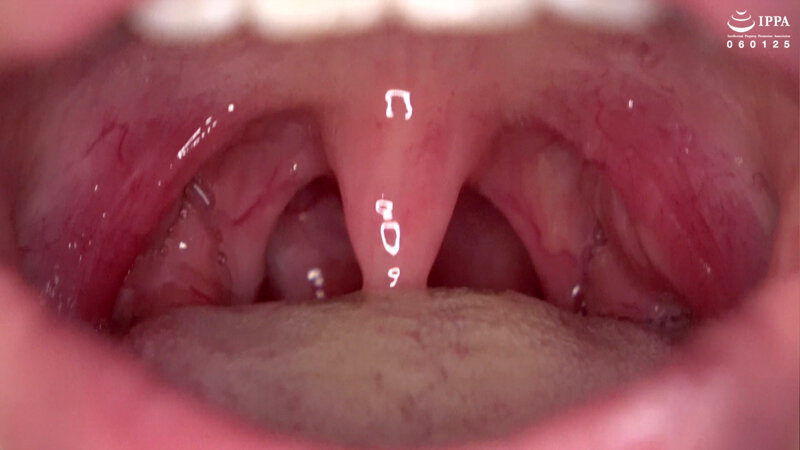 ad-1525 sample