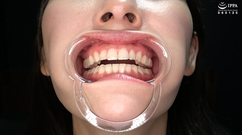 ad-1708 sample
