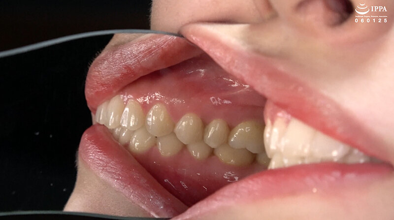 ad-1708 sample