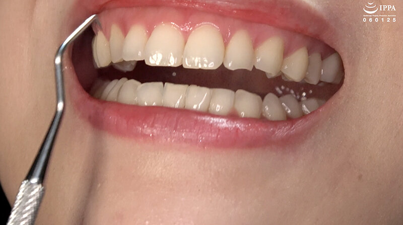 ad-1708 sample