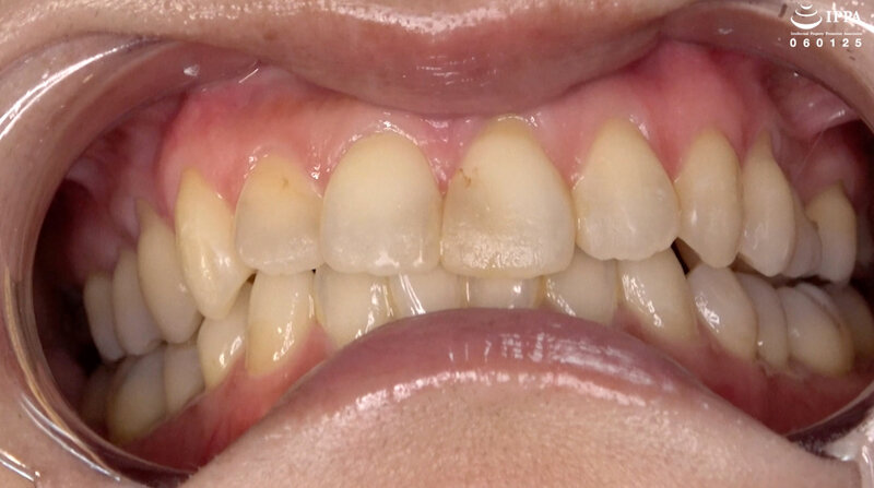 ad-1840 sample
